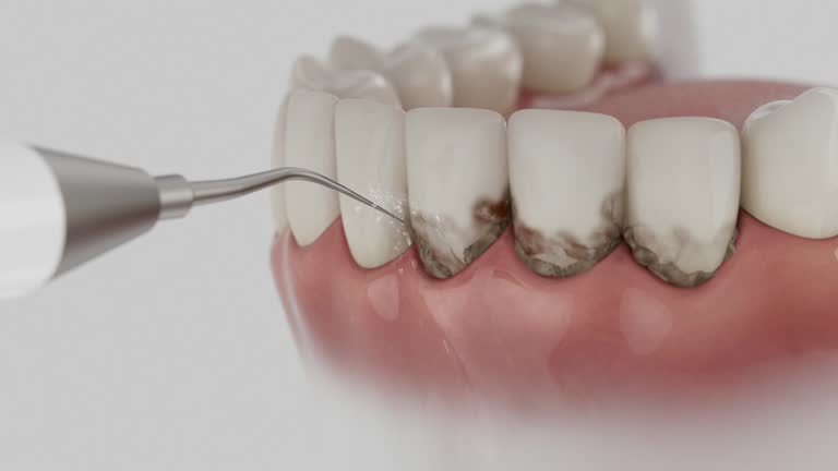 Reliable Emergency Dentist contractor in Bellbrook, OH by Smile Center Dentistry
